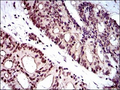 WHSC2 Antibody in Immunohistochemistry (Paraffin) (IHC (P))