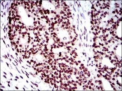 WHSC2 Antibody in Immunohistochemistry (Paraffin) (IHC (P))