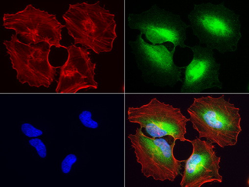 WIBG Antibody in Immunocytochemistry (ICC/IF)