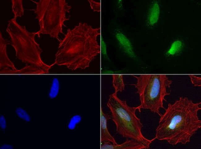 WIBG Antibody in Immunocytochemistry (ICC/IF)