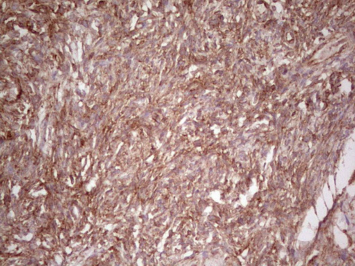 WIBG Antibody in Immunohistochemistry (Paraffin) (IHC (P))