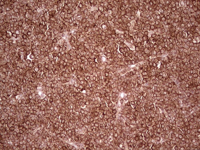 WIBG Antibody in Immunohistochemistry (Paraffin) (IHC (P))