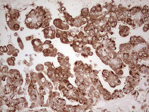 WIBG Antibody in Immunohistochemistry (Paraffin) (IHC (P))