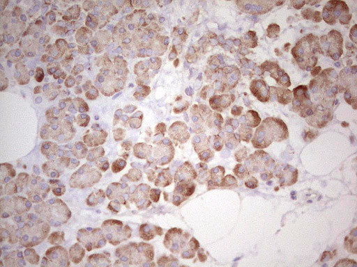 WIBG Antibody in Immunohistochemistry (Paraffin) (IHC (P))