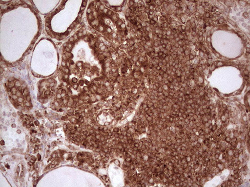 WIBG Antibody in Immunohistochemistry (Paraffin) (IHC (P))