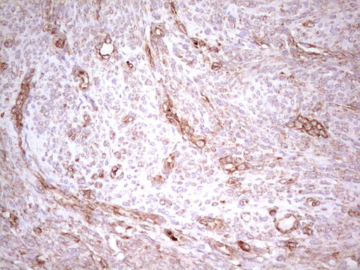 WIBG Antibody in Immunohistochemistry (Paraffin) (IHC (P))