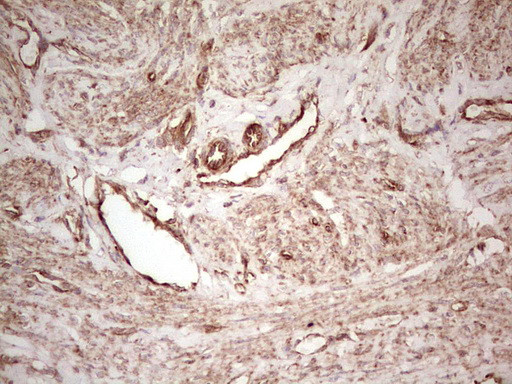 WIBG Antibody in Immunohistochemistry (Paraffin) (IHC (P))