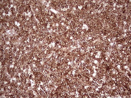 WIBG Antibody in Immunohistochemistry (Paraffin) (IHC (P))