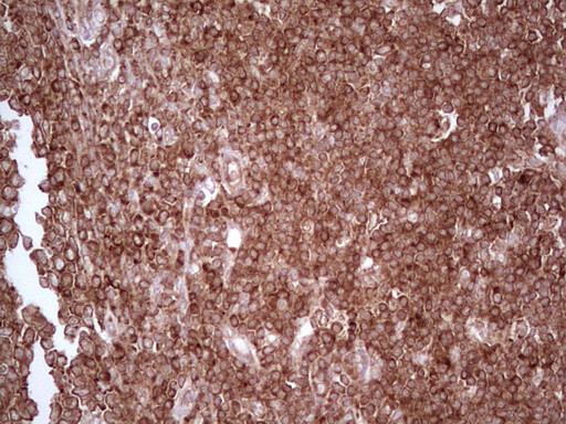 WIBG Antibody in Immunohistochemistry (Paraffin) (IHC (P))