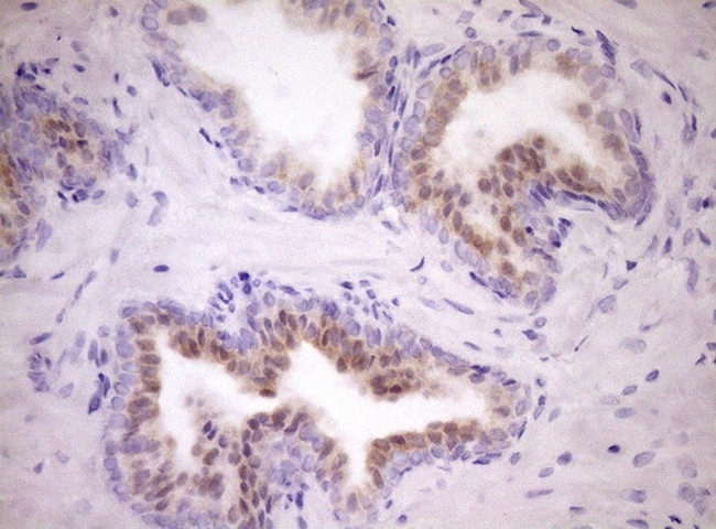 WIBG Antibody in Immunohistochemistry (Paraffin) (IHC (P))