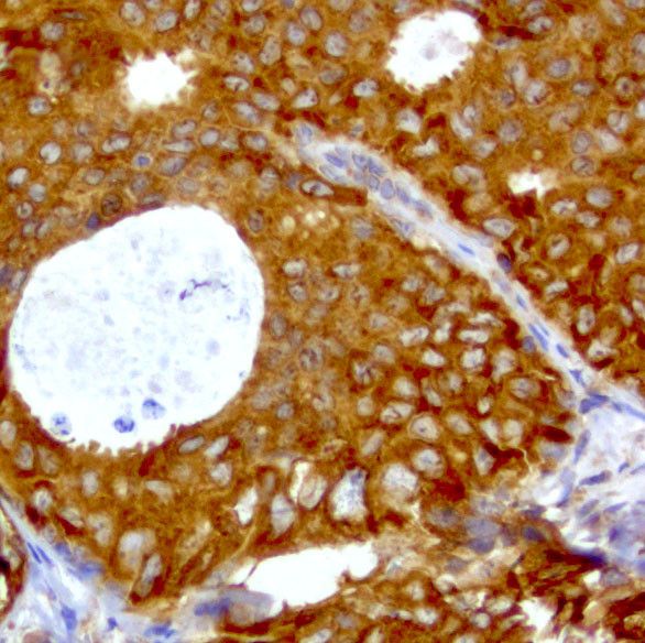 WIBG Antibody in Immunohistochemistry (Paraffin) (IHC (P))