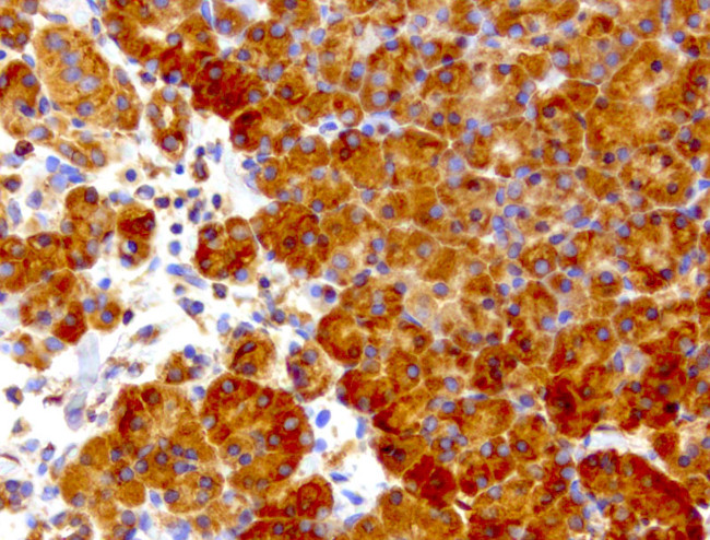 WIBG Antibody in Immunohistochemistry (Paraffin) (IHC (P))