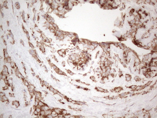 WIBG Antibody in Immunohistochemistry (Paraffin) (IHC (P))