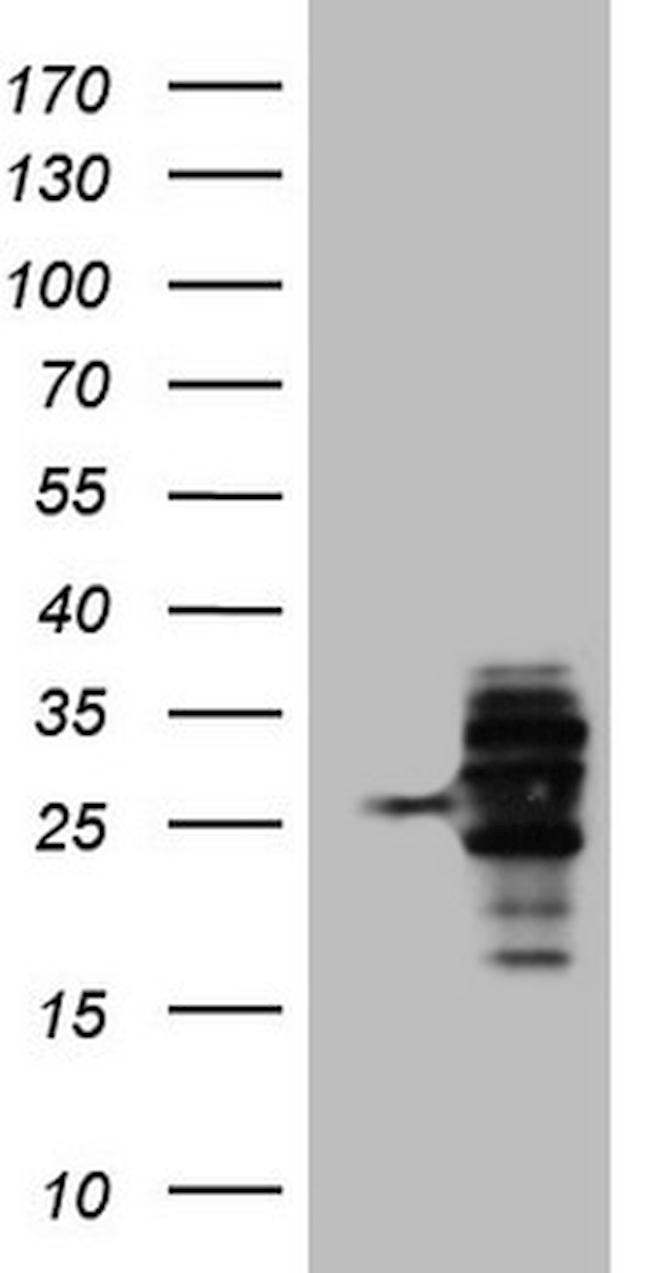 WIBG Antibody in Western Blot (WB)