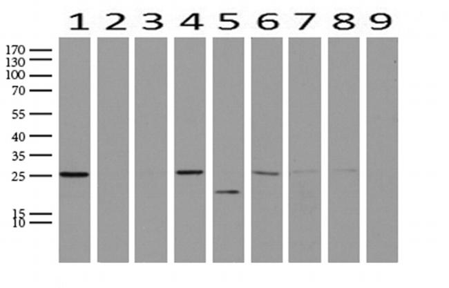 WIBG Antibody in Western Blot (WB)