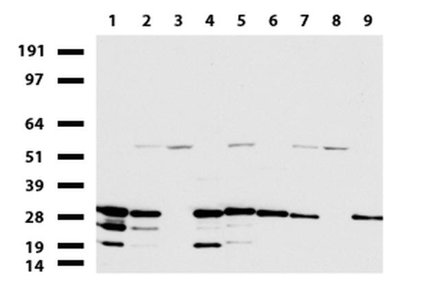 WIBG Antibody in Western Blot (WB)