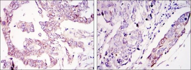 WIF1 Antibody in Immunohistochemistry (Paraffin) (IHC (P))