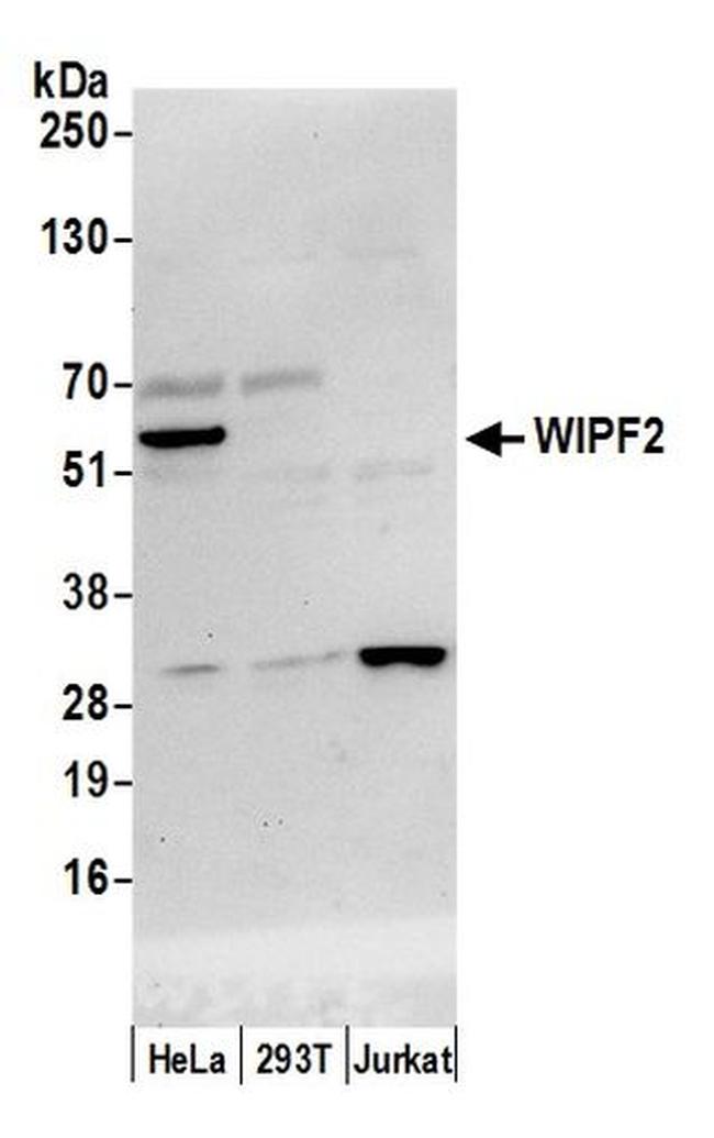 WIPF2/WIRE Antibody in Western Blot (WB)