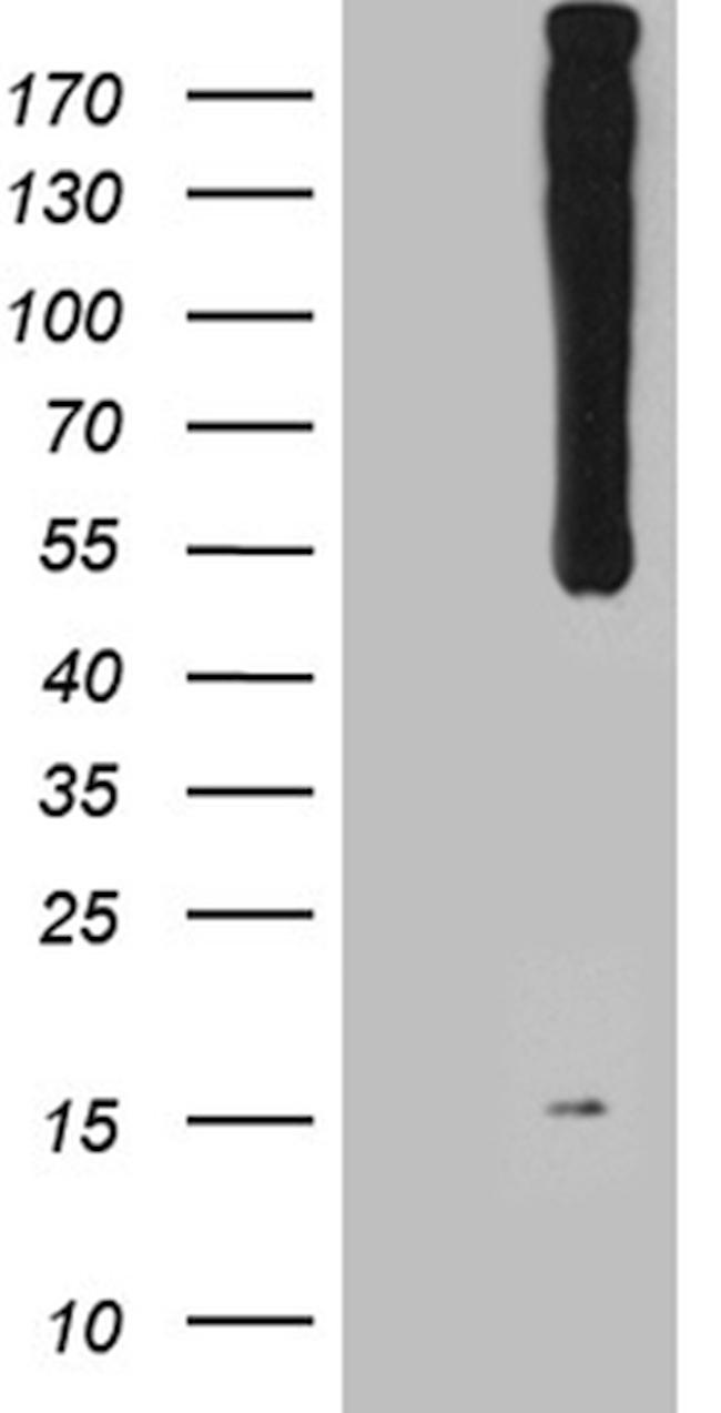 WIPI1 Antibody in Western Blot (WB)