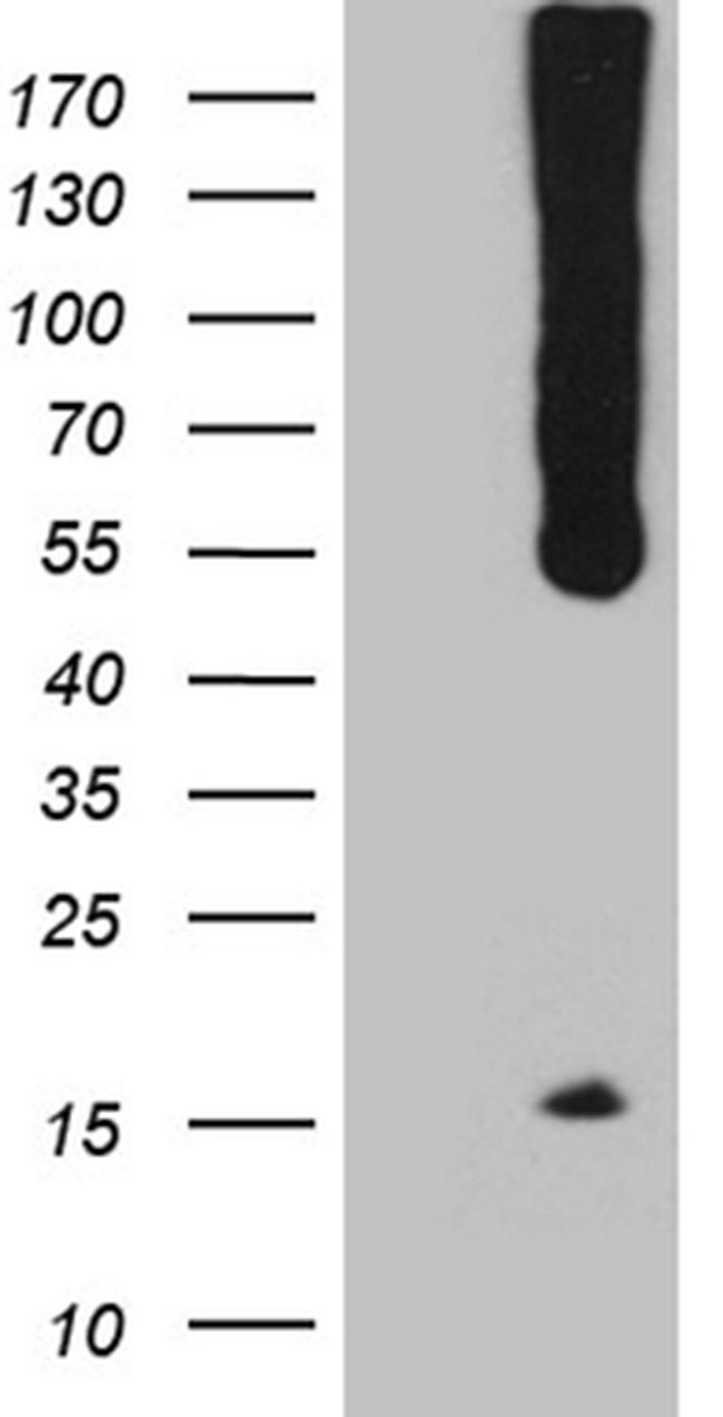 WIPI1 Antibody in Western Blot (WB)