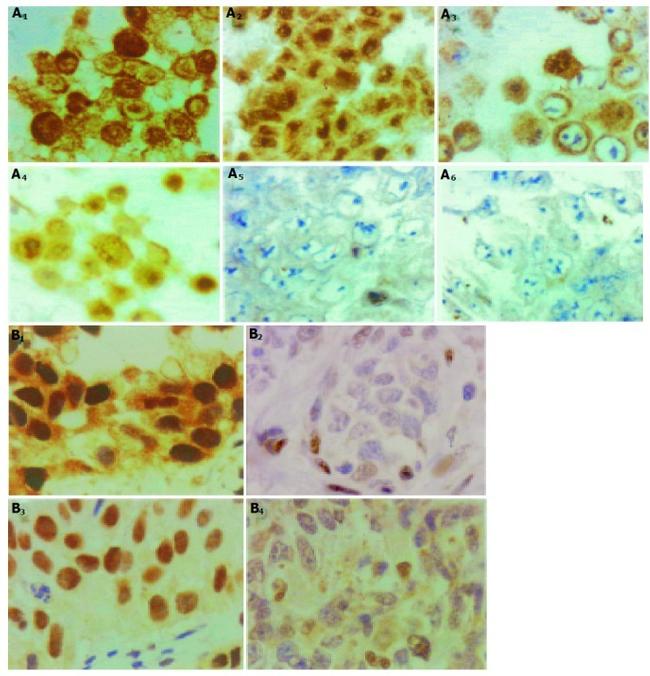 Glucocorticoid Receptor Antibody in Immunohistochemistry (Paraffin) (IHC (P))