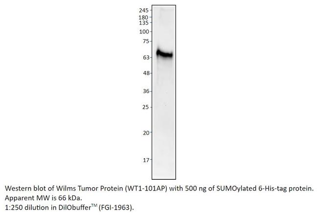 Wilms Tumor Protein Antibody in Western Blot (WB)