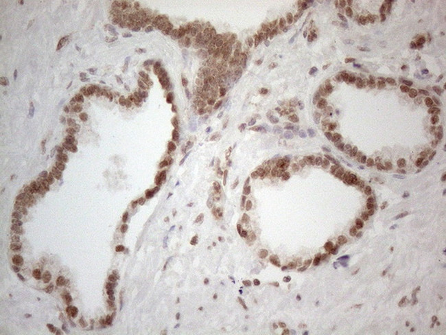 WTAP Antibody in Immunohistochemistry (Paraffin) (IHC (P))