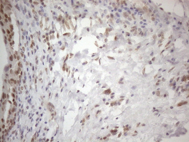 WTAP Antibody in Immunohistochemistry (Paraffin) (IHC (P))