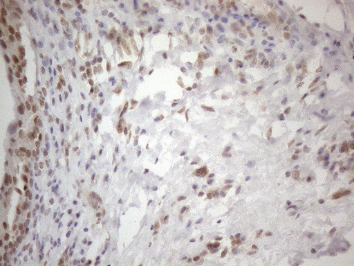 WTAP Antibody in Immunohistochemistry (Paraffin) (IHC (P))