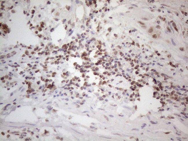 WTAP Antibody in Immunohistochemistry (Paraffin) (IHC (P))