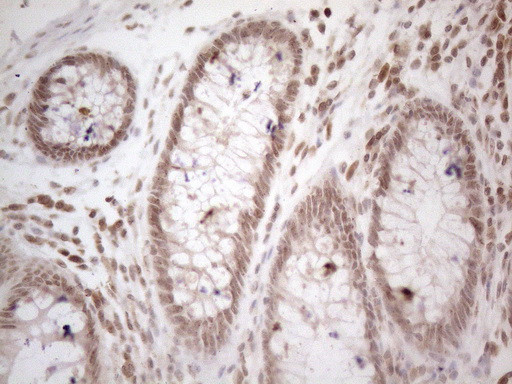 WTAP Antibody in Immunohistochemistry (Paraffin) (IHC (P))