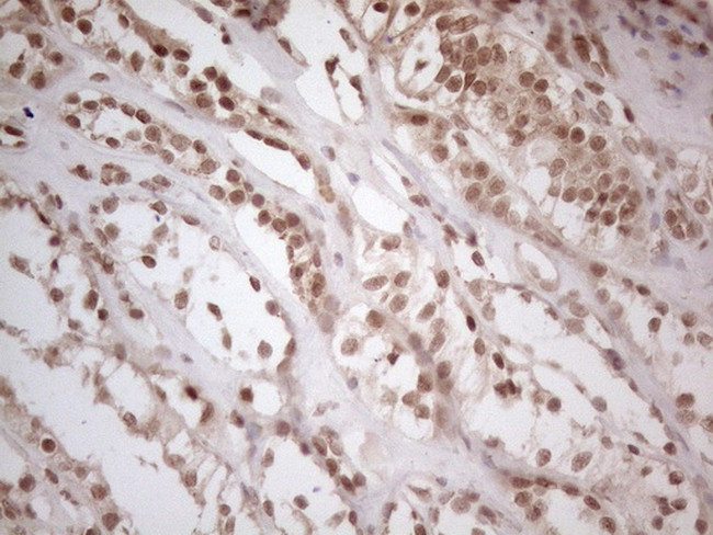 WTAP Antibody in Immunohistochemistry (Paraffin) (IHC (P))