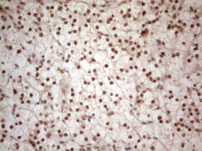 WTAP Antibody in Immunohistochemistry (Paraffin) (IHC (P))