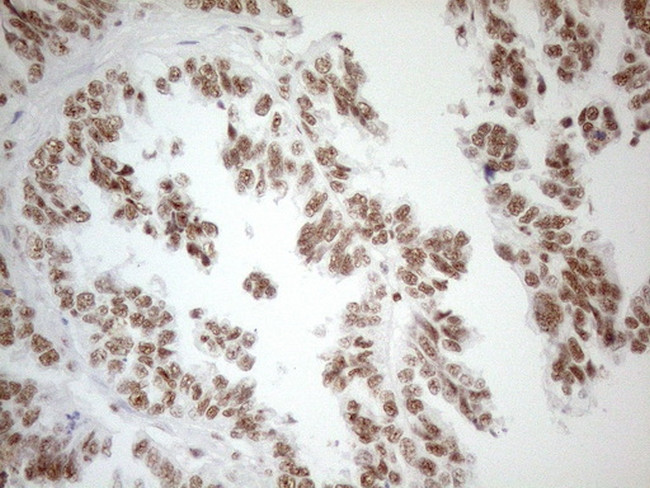 WTAP Antibody in Immunohistochemistry (Paraffin) (IHC (P))