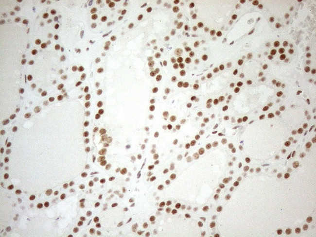 WTAP Antibody in Immunohistochemistry (Paraffin) (IHC (P))