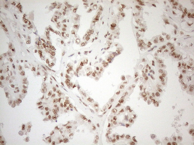 WTAP Antibody in Immunohistochemistry (Paraffin) (IHC (P))