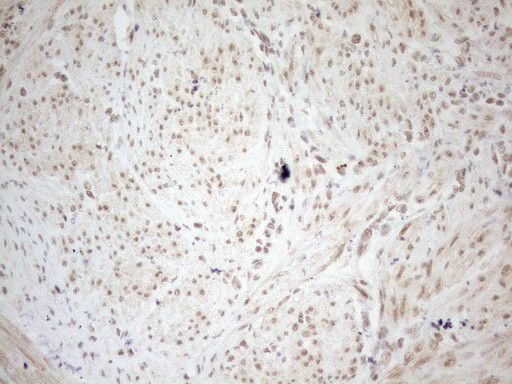 WTAP Antibody in Immunohistochemistry (Paraffin) (IHC (P))