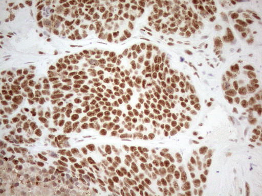 WTAP Antibody in Immunohistochemistry (Paraffin) (IHC (P))