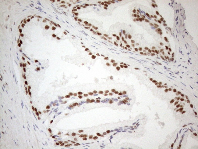 WTAP Antibody in Immunohistochemistry (Paraffin) (IHC (P))