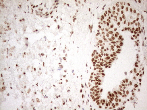 WTAP Antibody in Immunohistochemistry (Paraffin) (IHC (P))