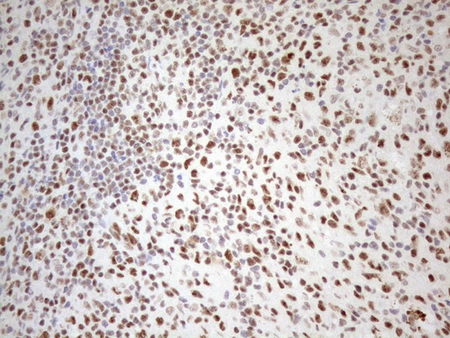 WTAP Antibody in Immunohistochemistry (Paraffin) (IHC (P))