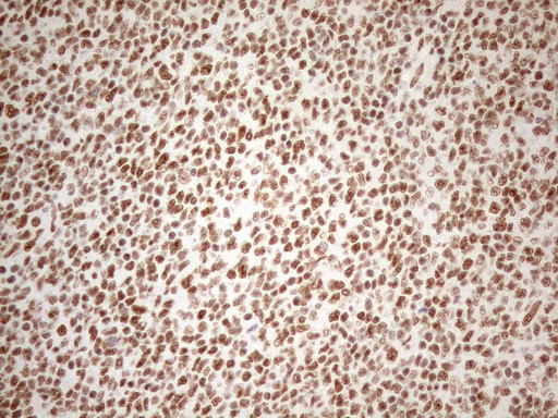 WTAP Antibody in Immunohistochemistry (Paraffin) (IHC (P))