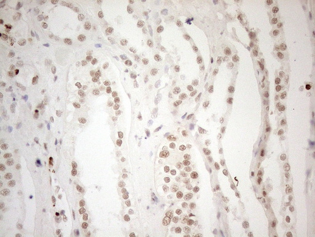 WTAP Antibody in Immunohistochemistry (Paraffin) (IHC (P))