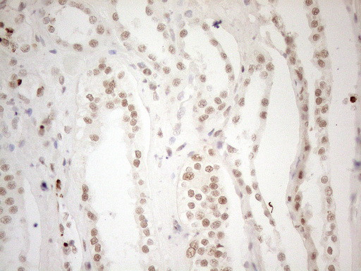 WTAP Antibody in Immunohistochemistry (Paraffin) (IHC (P))