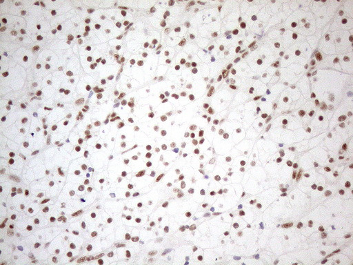 WTAP Antibody in Immunohistochemistry (Paraffin) (IHC (P))