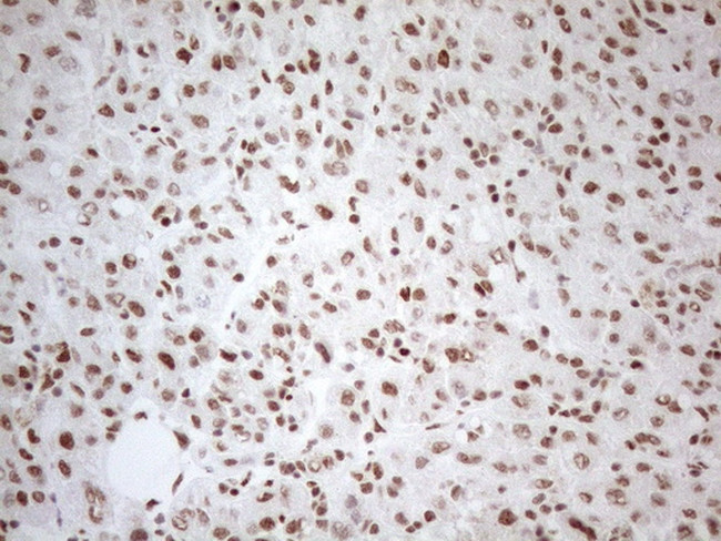 WTAP Antibody in Immunohistochemistry (Paraffin) (IHC (P))