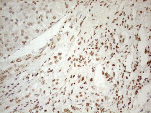 WTAP Antibody in Immunohistochemistry (Paraffin) (IHC (P))