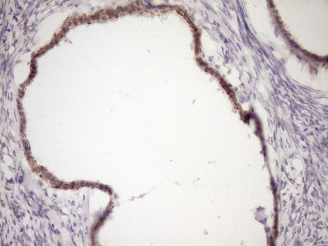 WTAP Antibody in Immunohistochemistry (Paraffin) (IHC (P))