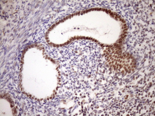 WTAP Antibody in Immunohistochemistry (Paraffin) (IHC (P))