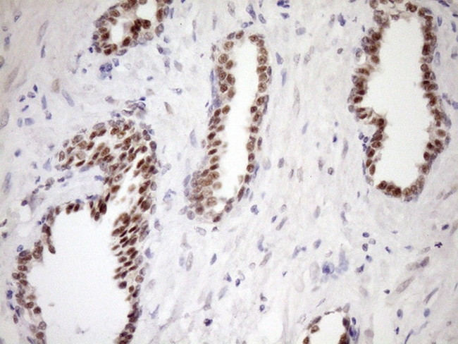 WTAP Antibody in Immunohistochemistry (Paraffin) (IHC (P))